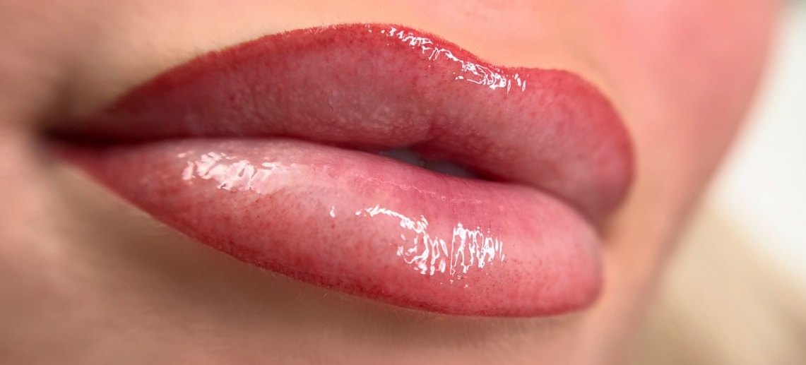 Glanzende lippen na een lipbehandeling